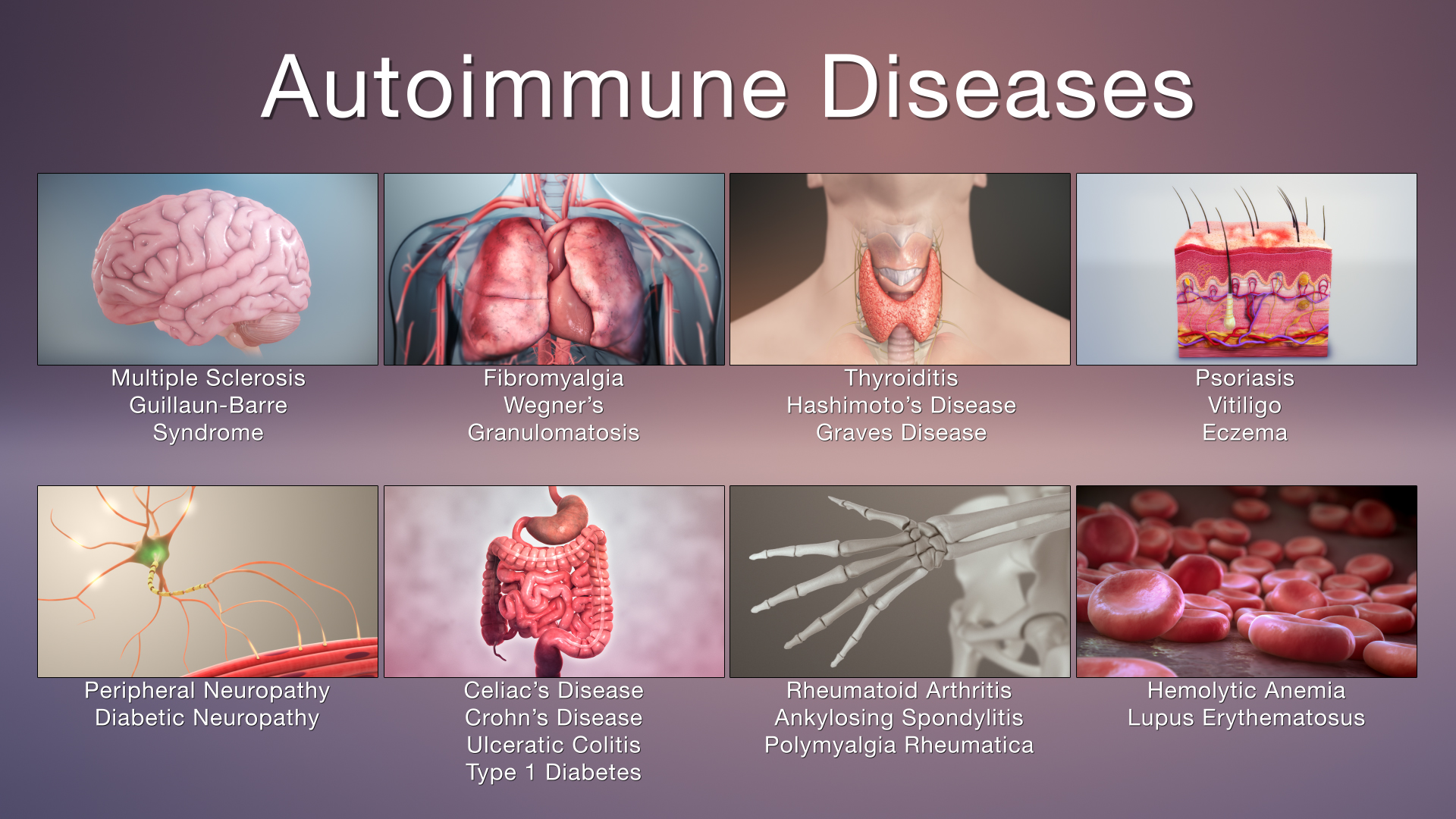 How Common Are Autoimmune Diseases