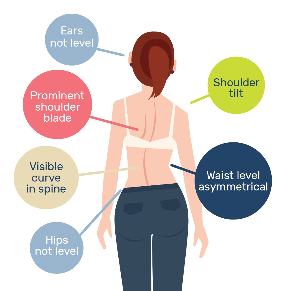 The Scoliosis Forward Bend Test: Procedure, Accuracy, and ...