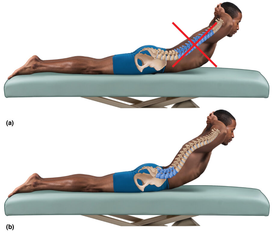 Understanding Hip Scoliosis: The Connection Between Spinal Curvature ...