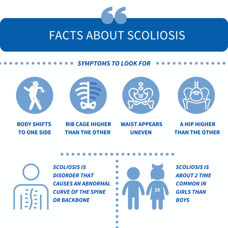 Scoliosis Exercises to Avoid: Key Exercises That May Worsen Scoliosis ...