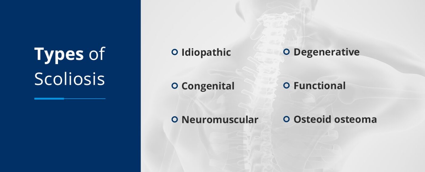 Classification of Scoliosis: A Comprehensive Guide to Types and ...