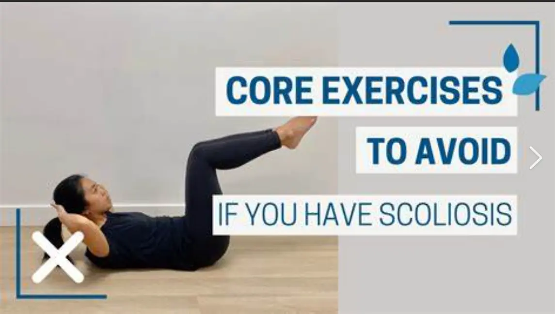 What Exercises to Avoid with Scoliosis Identifying Exercises That May